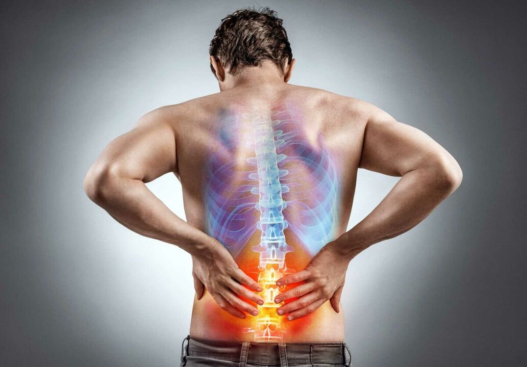 Nugaros skausmas