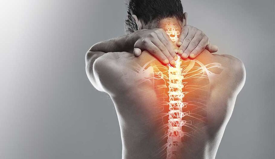 Kaklo osteochondrozė