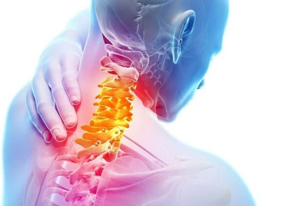 Gimdos kaklelio stuburo osteochondrozė
