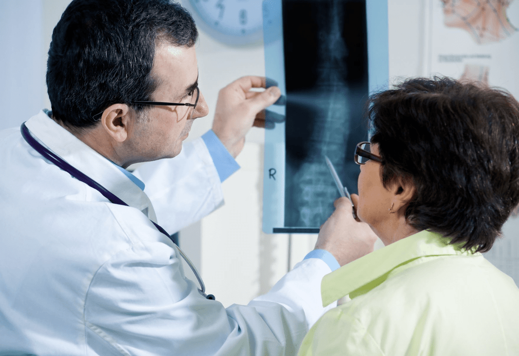 Neurologas diagnozuoja osteochondrozę, naudodamas stuburo rentgenografiją