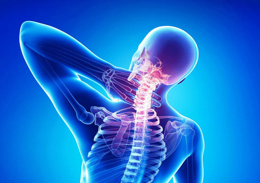 Stuburo osteochondrozė