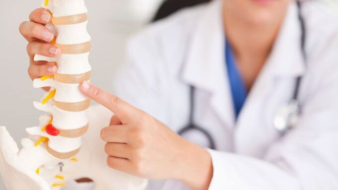 juosmens osteochondrozės paaiškinimas stuburo modeliu